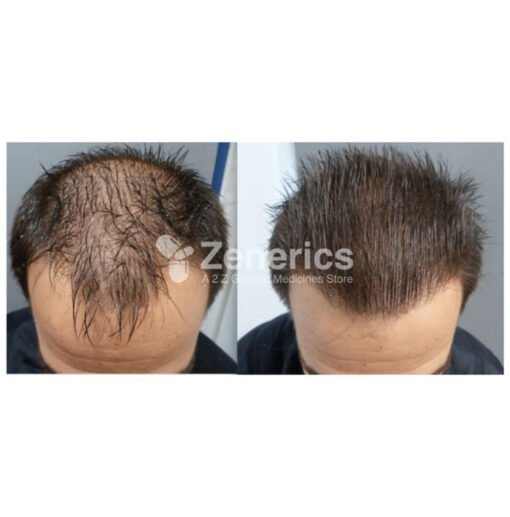 Tinfal Plus Solution - Image 3